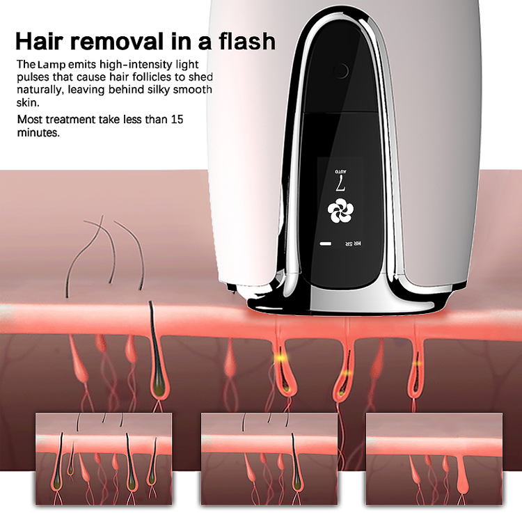 OEM-Haarentferner IPL-Haarentfernungslaser Schmerzlose Ganzkörper-Hautverjüngung  